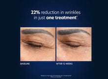 Load image into Gallery viewer, PCA Skin Hyaluronic Acid Microneedle Eye Patches