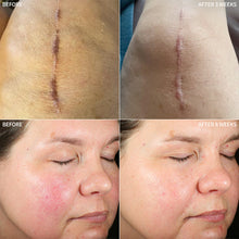 Load image into Gallery viewer, RescueMD DNA Repair Complex  Skin Damage + Scar Treatment Solution 120 ml