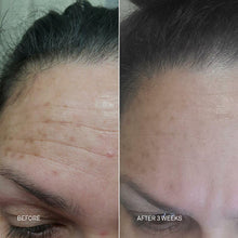 Load image into Gallery viewer, RescueMD DNA Repair Complex 30mL The Ultimate Skin Damage + Scar Treatment