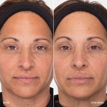 Load image into Gallery viewer, HydroPeptide Retinol Routine Booster 1% Retinol Solution