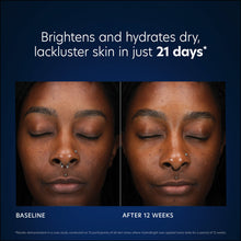 Cargar imagen en el visor de la galería, PCA Skin HydraBright