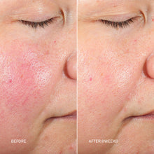 Load image into Gallery viewer, RescueMD DNA Repair Complex 30mL The Ultimate Skin Damage + Scar Treatment