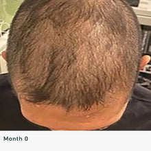 Load image into Gallery viewer, Kizo Lab Follicle Activator Hair Serum