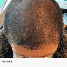 Load image into Gallery viewer, Kizo Lab Follicle Activator Hair Serum