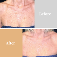 Load image into Gallery viewer, Omnilux Contour Neck & Decollete - European Beauty by B
