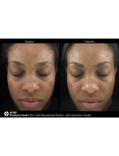 Load image into Gallery viewer, Jan Marini Age Intervention Duality - European Beauty by B