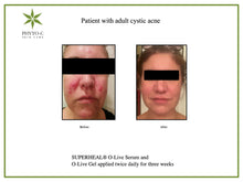Load image into Gallery viewer, Phyto-C Skin Care Superheal™ O-Live Serum 30ml - European Beauty by B