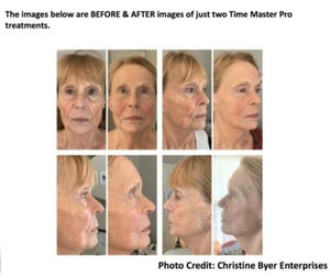 Time Master Pro LED NO EMS for Very Sensitive Skin with Collagen Gel - European Beauty by B