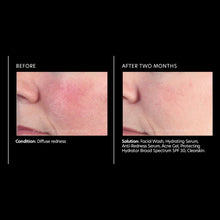 Load image into Gallery viewer, PCA Skin Anti-Redness Serum 1 oz - European Beauty by B