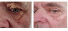 Load image into Gallery viewer, Myskinbuddy Orion™ is The Smart Photon Handheld that’s better than your Panel