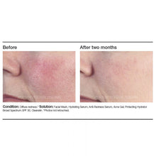 Load image into Gallery viewer, PCA Skin Anti-Redness Serum 1 oz - European Beauty by B