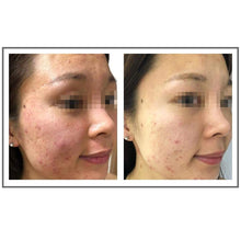 Cargar imagen en el visor de la galería, Glowbiotics Calming Restoration Treatment - European Beauty by B