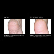 Cargar imagen en el visor de la galería, PCA Skin Body Therapy 7 oz - European Beauty by B