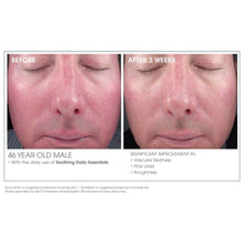 Cargar imagen en el visor de la galería, Glowbiotics Calming Restoration Treatment - European Beauty by B