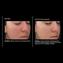 Load image into Gallery viewer, PCA Skin Dual Action Redness Relief 1 oz - European Beauty by B