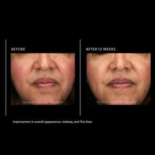 Load image into Gallery viewer, PCA Skin Resurfacing Serum 1 fl oz