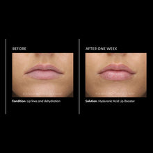 Load image into Gallery viewer, PCA Skin Hyaluronic Acid Lip Booster - European Beauty by B