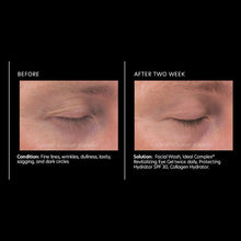 Load image into Gallery viewer, PCA Skin Ideal Complex Revitalizing Eye Gel 0.5oz - European Beauty by B