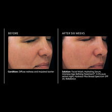Load image into Gallery viewer, PCA Skin Intensive Age Refining Treatment 0.5% pure retinol 1 oz - European Beauty by B