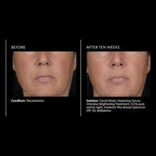 Load image into Gallery viewer, PCA Skin Intensive Brightening Treatment: 0.5% pure retinol 1 oz - European Beauty by B