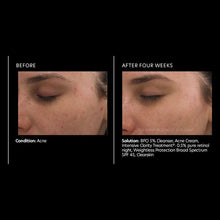 Load image into Gallery viewer, PCA Skin Intensive Clarity Treatment 0.5% Pure Retinol & Salicylic Acid 1 oz - European Beauty by B