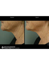 Cargar imagen en el visor de la galería, Jan Marini Marini Juveneck - European Beauty by B