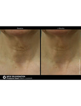 Cargar imagen en el visor de la galería, Jan Marini Marini Juveneck - European Beauty by B