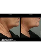 Cargar imagen en el visor de la galería, Jan Marini Marini Juveneck - European Beauty by B