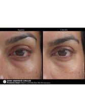 Cargar imagen en el visor de la galería, Jan Marini Marini Luminate Eye Gel - European Beauty by B