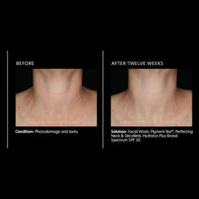 Load image into Gallery viewer, PCA Skin Perfecting Neck and Décolleté 3.0 oz - European Beauty by B