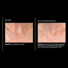 Load image into Gallery viewer, PCA Skin Pigment Bar 3.2 oz - European Beauty by B