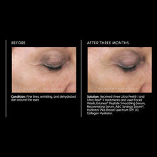 Cargar imagen en el visor de la galería, PCA Skin Rejuvenating Serum 1 fl oz - European Beauty by B
