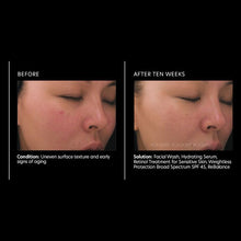 Load image into Gallery viewer, PCA Skin Retinol Treatment for Sensitive Skin 1 oz - European Beauty by B