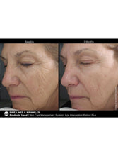 Cargar imagen en el visor de la galería, Jan Marini Age Intervention Retinol Plus - European Beauty by B