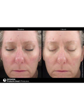 Load image into Gallery viewer, Jan Marini RosaLieve - European Beauty by B