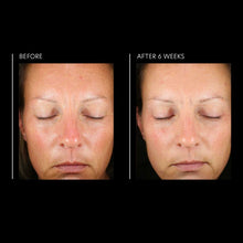 Load image into Gallery viewer, PCA Skin Hyaluronic Acid Overnight Mask 1.8 fl oz - European Beauty by B