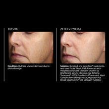 Load image into Gallery viewer, PCA Skin Vitamin B3 Eye Brightening Serum