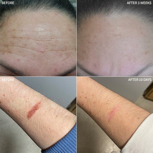 RescueMD DNA Repair Complex  Skin Damage + Scar Treatment Solution 15 ml