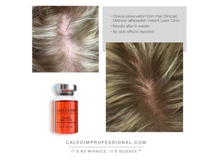 Calecim Professional Advanced Hair System 6 week treatment program 6 x 5ml
