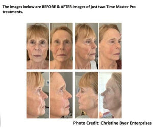 Time Master Pro LED with Collagen Gel - European Beauty by B