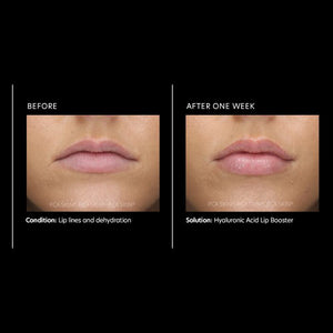 PCA Skin Hyaluronic Acid Lip Booster - European Beauty by B