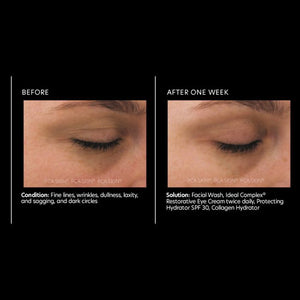 PCA Skin Ideal Complex Revitalizing Eye Gel 0.5oz - European Beauty by B