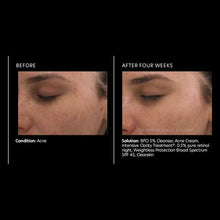 Load image into Gallery viewer, PCA Skin Intensive Clarity Treatment 0.5% Pure Retinol &amp; Salicylic Acid 1 oz - European Beauty by B
