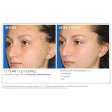Load image into Gallery viewer, Glowbiotics Acne Clarifying + Refining Treatment - European Beauty by B