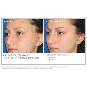 Glowbiotics Acne Clarifying + Refining Treatment - European Beauty by B