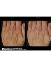 Cargar imagen en el visor de la galería, Jan Marini Marini ReNu Corrective Hand Complex - European Beauty by B
