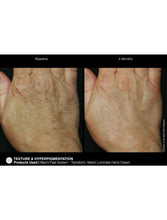 Cargar imagen en el visor de la galería, Jan Marini Marini ReNu Corrective Hand Complex - European Beauty by B

