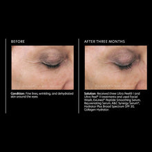 Load image into Gallery viewer, PCA Skin Rejuvenating Serum 1 fl oz - European Beauty by B