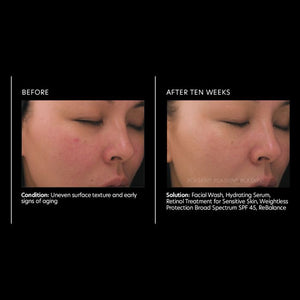 PCA Skin Retinol Treatment for Sensitive Skin 1 oz - European Beauty by B