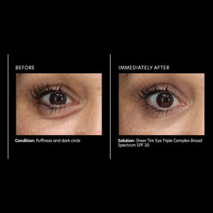 PCA Skin Sheer Tint Eye Triple Complex Broad Spectrum SPF 30 0.4 oz - European Beauty by B